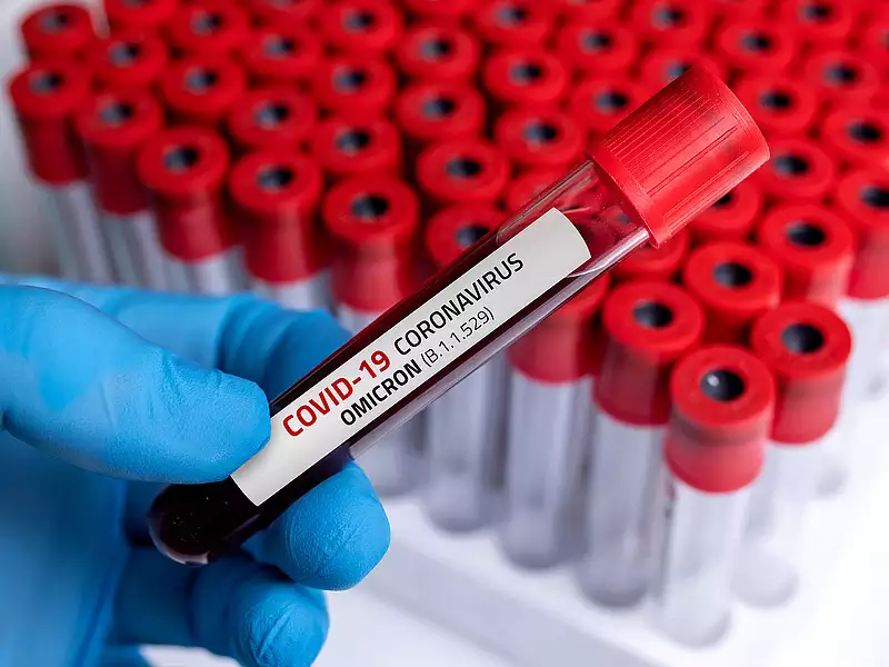 Több mint kétezren haltak meg koronavírusban az elmúlt 24 órában