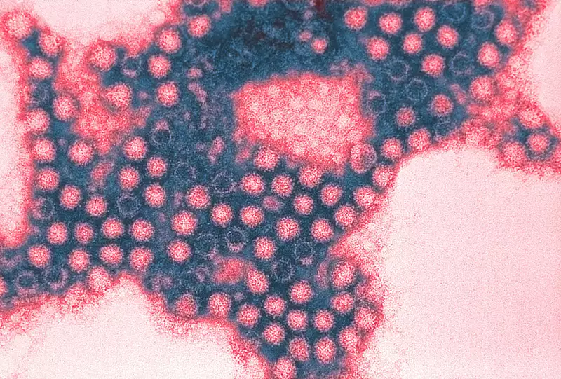 Koronavírus: 600 további halott, 280 ezer új megbetegedés